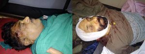 जम्मू-कश्मीर भाजपा सचिव और उनके भाई की किश्तवार में गोली मार कर हत्या